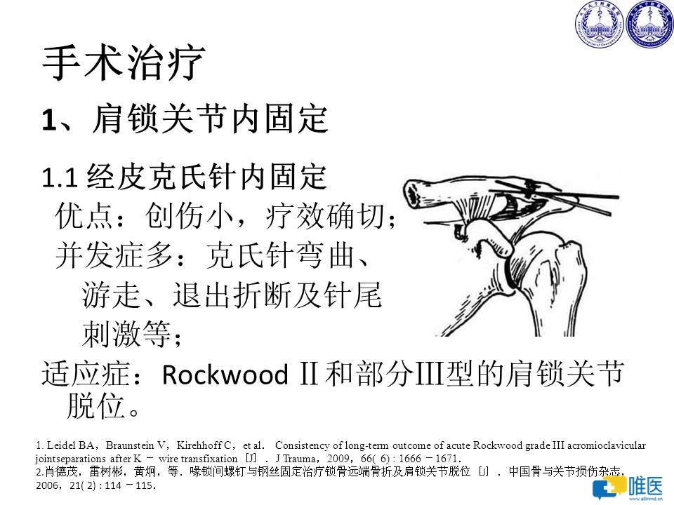 肩锁关节脱位的诊断与治疗