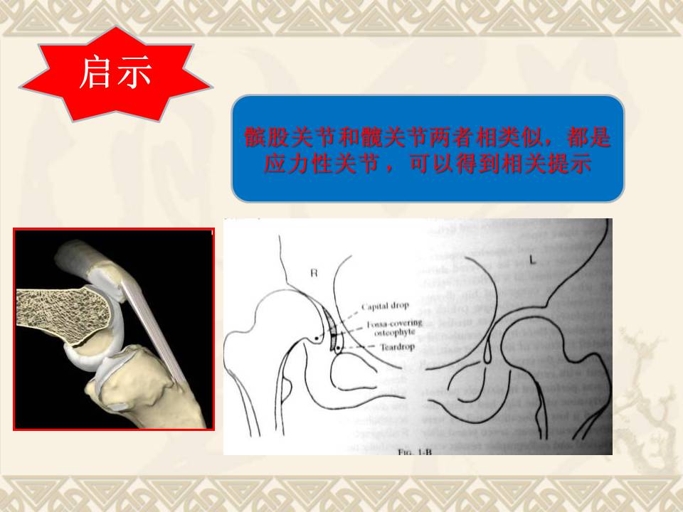 髌骨脱位及早期复位对股骨滑车发育的影响动物实验研究