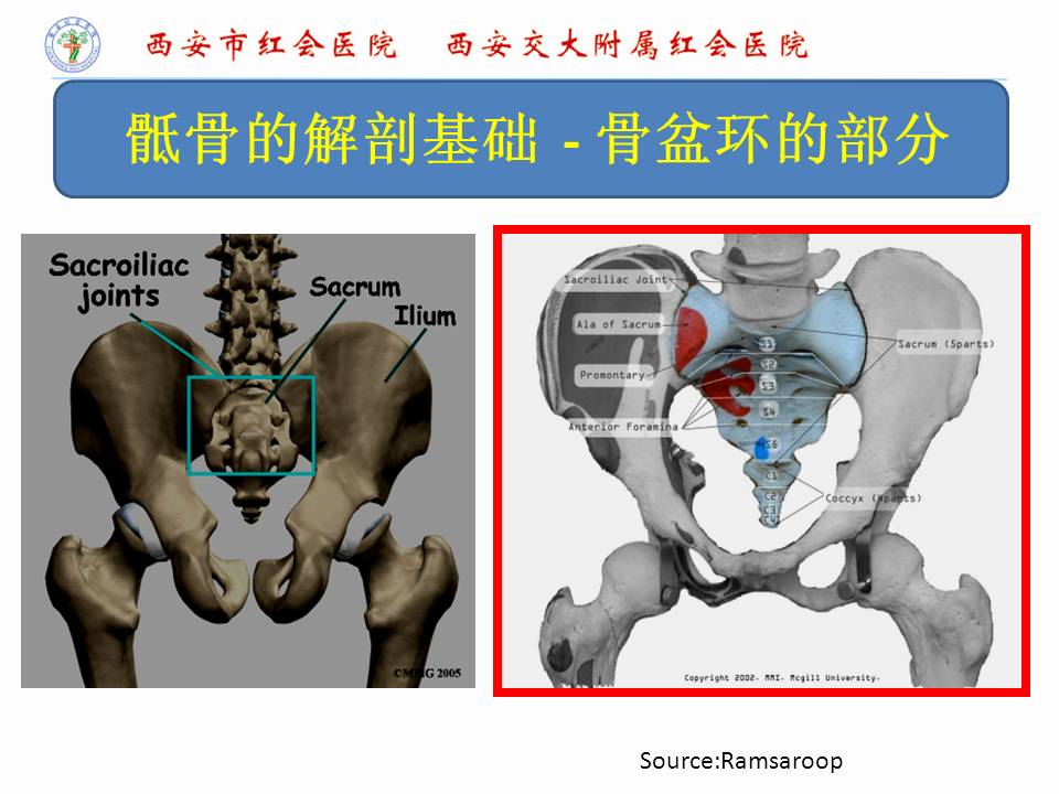 急性腰骶椎骨折的复位固定技术