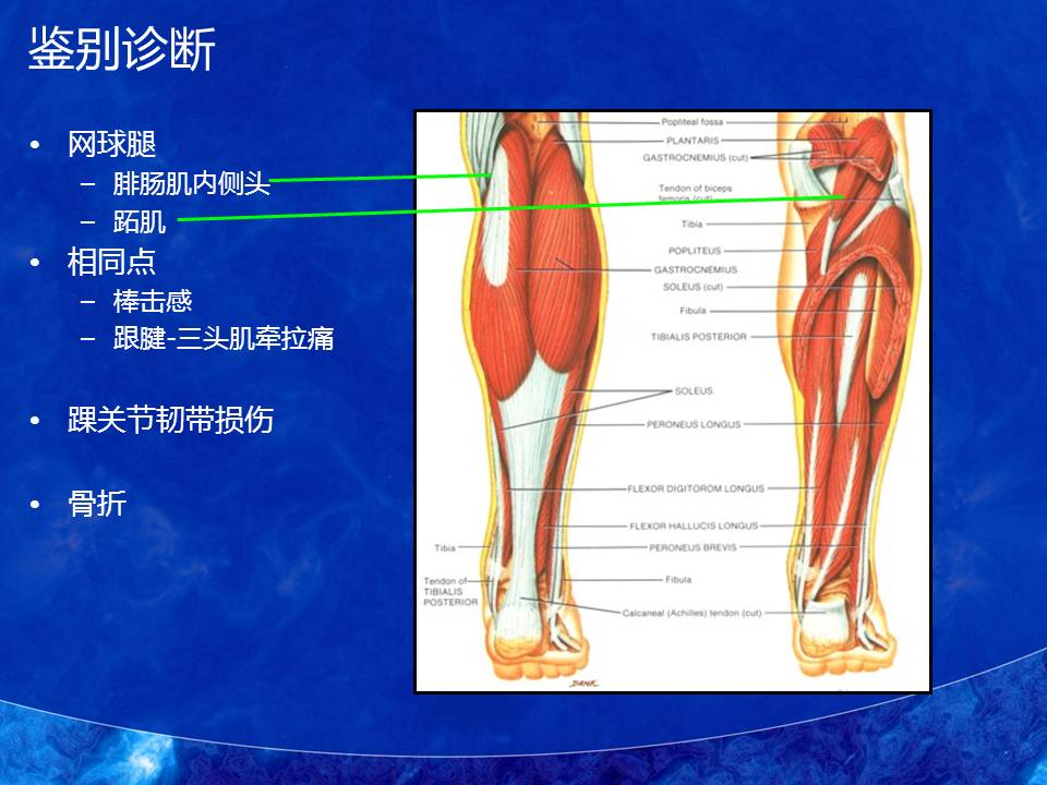 运动性跟腱断裂的诊断和处理