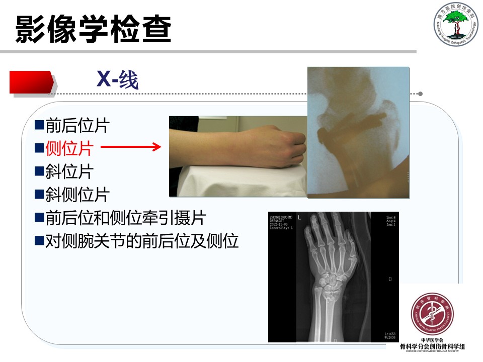 桡骨远端骨折的解剖及手术入路