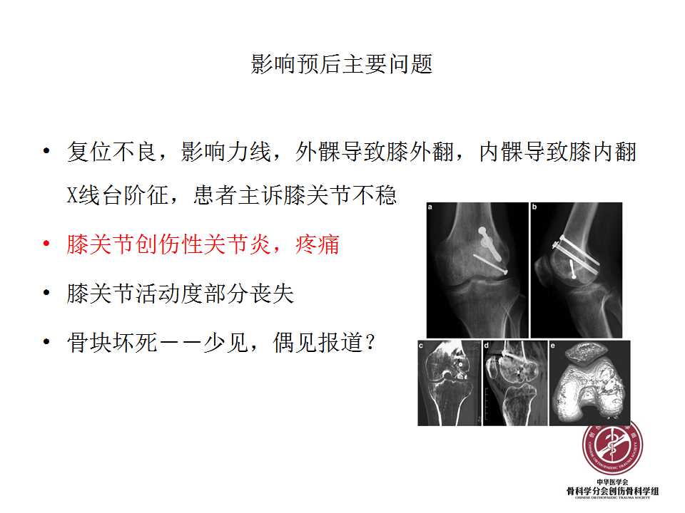 股骨远端hoffa骨折手术入路及固定