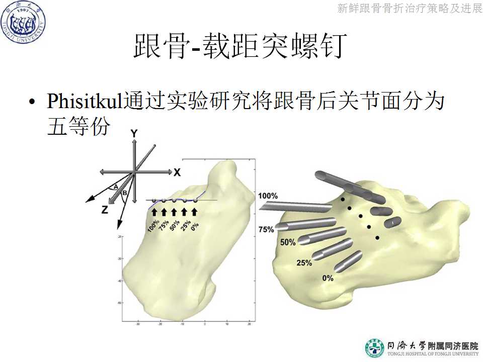 讨论了各种跟骨钢板的演变及选择.