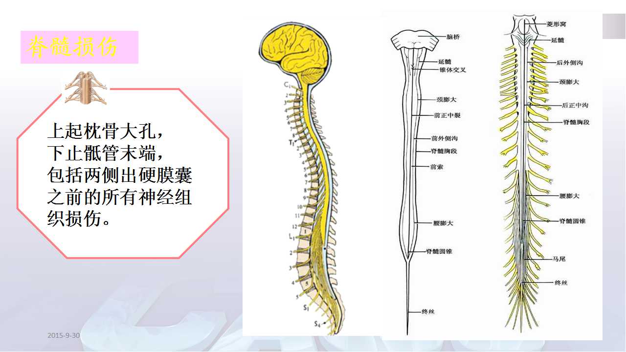ilizarov外固定技术在脊髓损伤后足踝重建中的应用