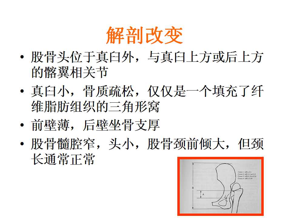 crowe iv 型ddh tha的肢体平衡