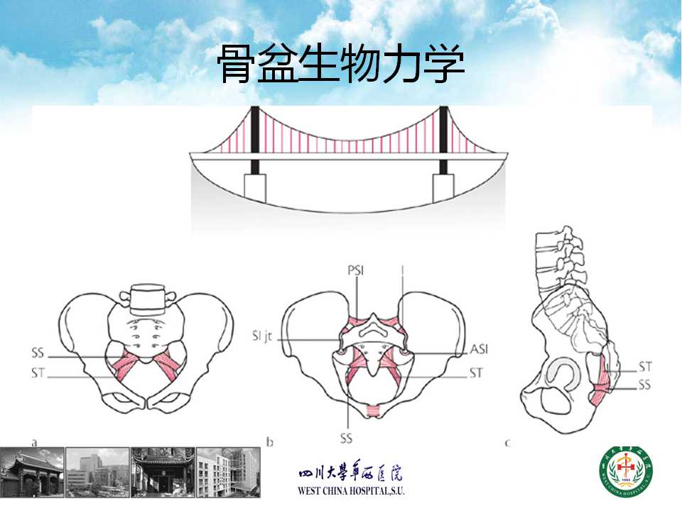 caos结合微创复位皮三维固定治疗不稳定骶骨骨折