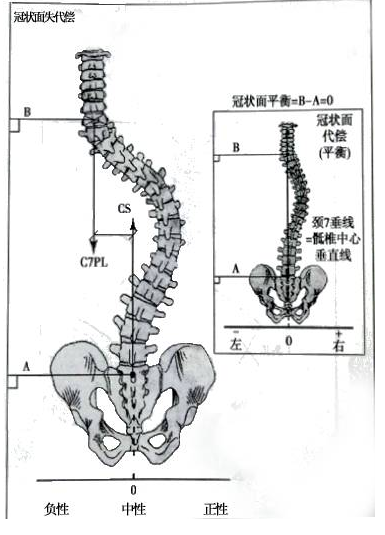 在全脊柱x线片上,经过骶骨棘突的中心作csvl,以c7两个椎弓根连线的