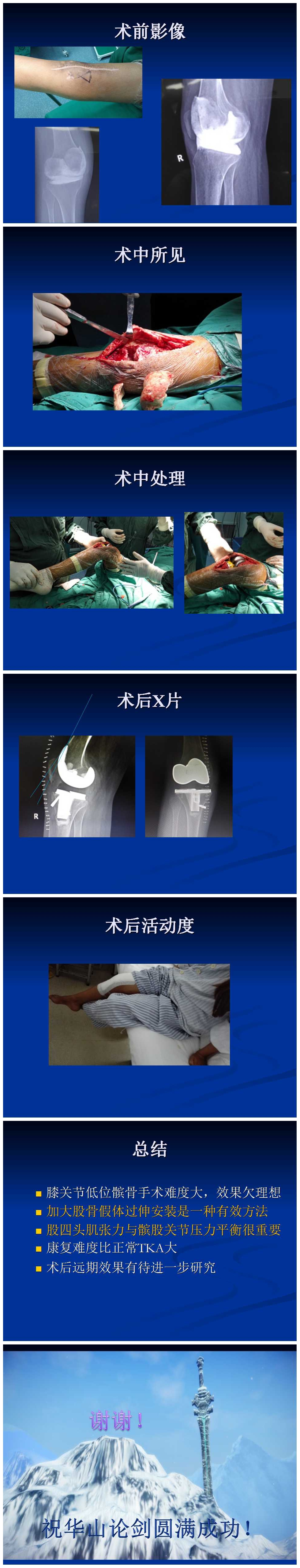 严重低位髌骨的膝关节置换
