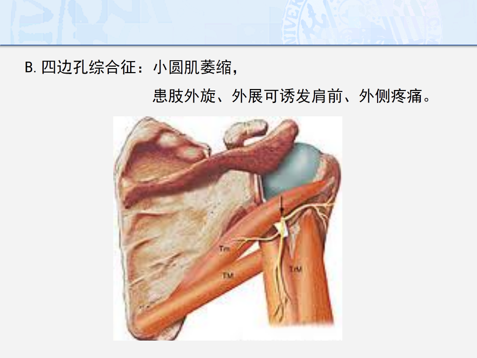 导致肩痛的情况通常包括:肩袖功能失调,粘连性肩关节囊炎,肩关节不