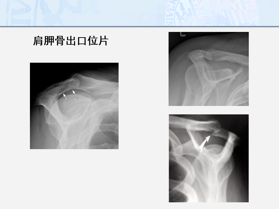 肩痛的诊断流程