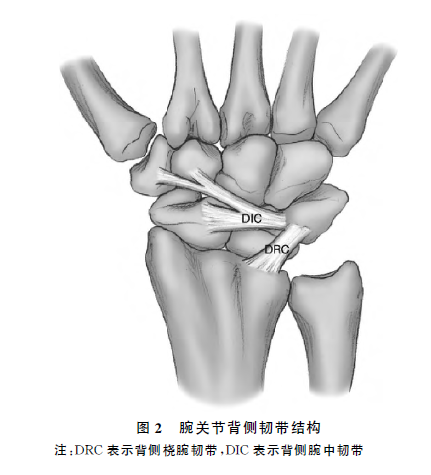 开放性手术各自的优缺点,目前主要有桡腕关节镜手术和腕中关节镜手术