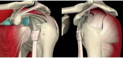 肩关节置换和肩袖功能重建