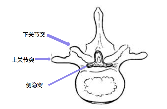 骨化,椎间盘后突,也可以是关节突肥大增生,从后方造成侧隐窝狭窄,压迫