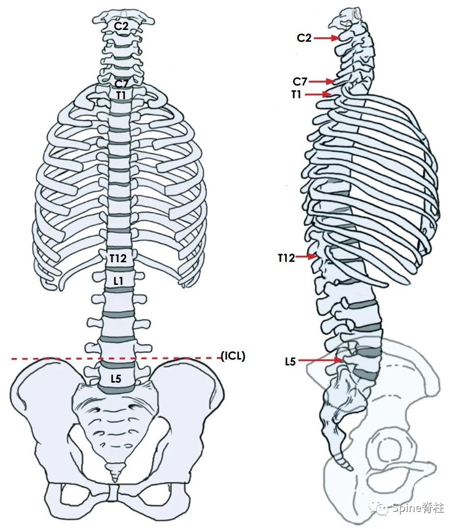 正常脊柱有12个胸椎,5个腰椎 icl:intercrestal line