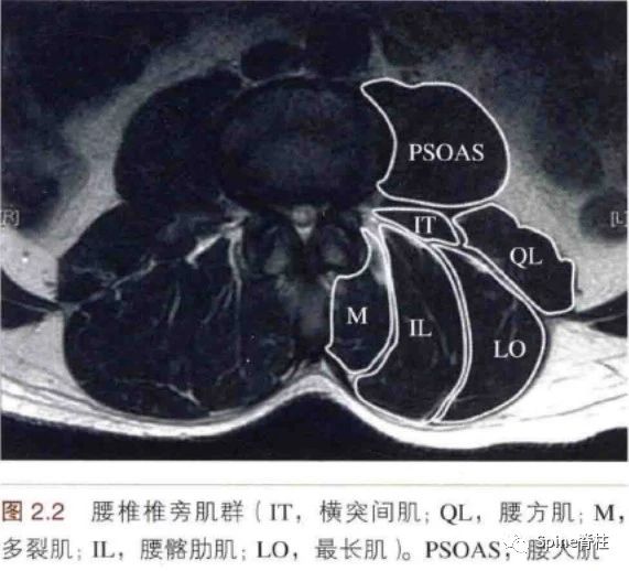 腰椎椎旁肌群