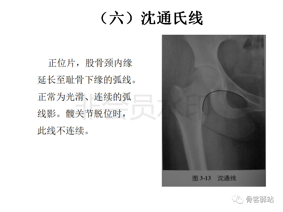 髋关节各种测量方法汇总图文版