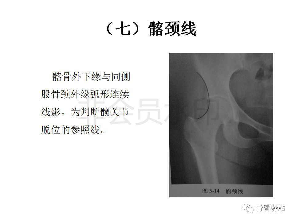 髋关节各种测量方法汇总图文版