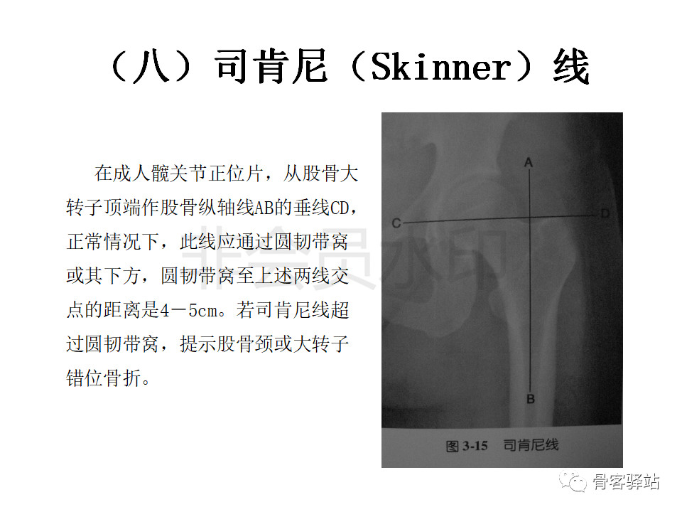 髋关节各种测量方法汇总图文版