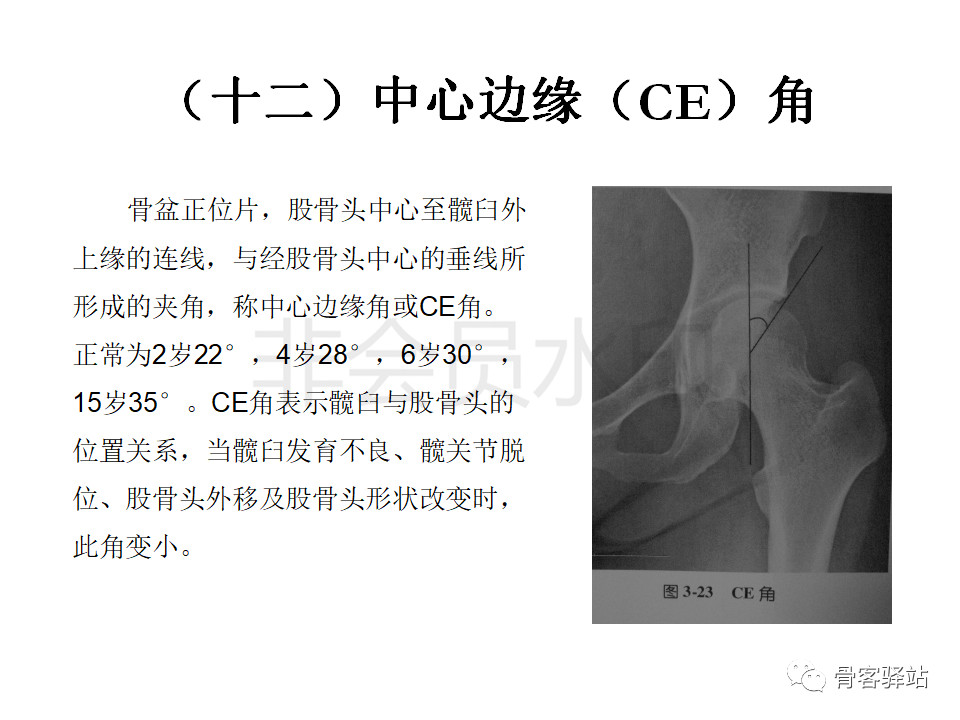 髋关节各种测量方法汇总图文版