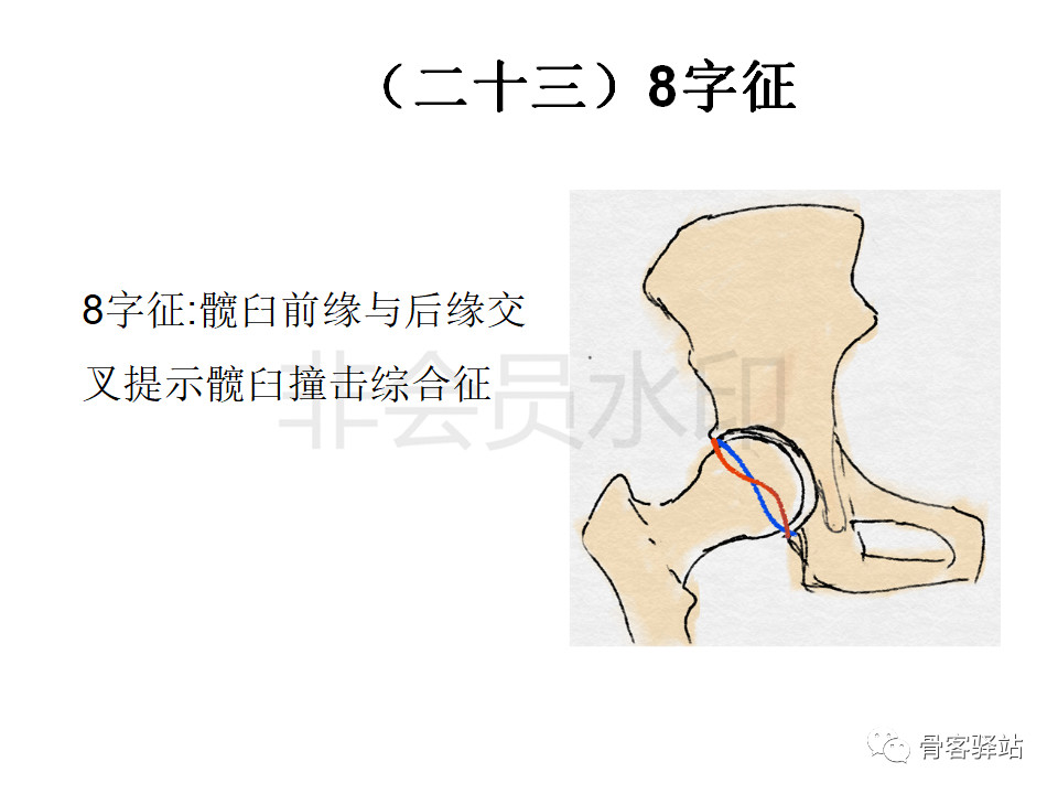 髋关节各种测量方法汇总图文版