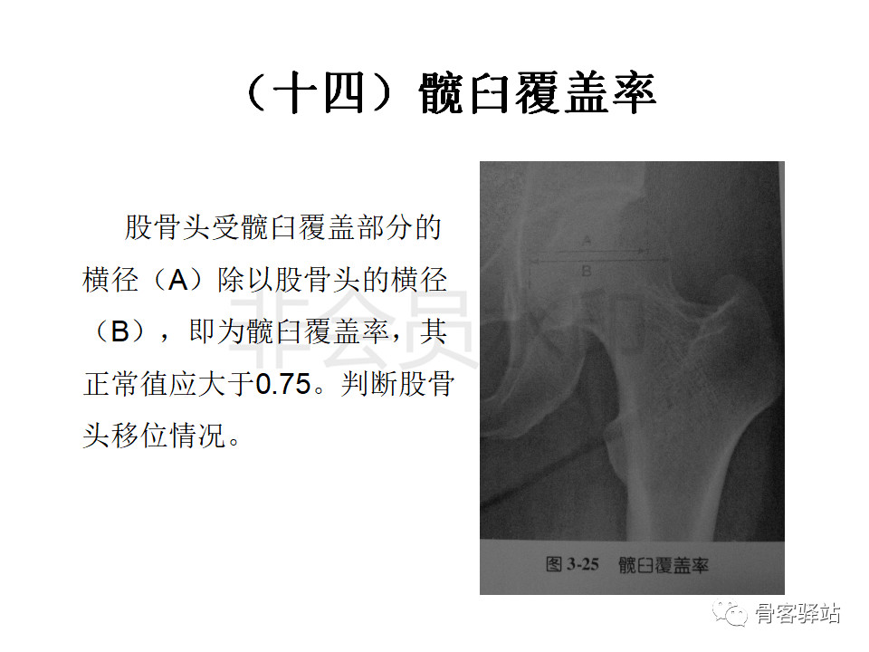 髋关节各种测量方法汇总图文版