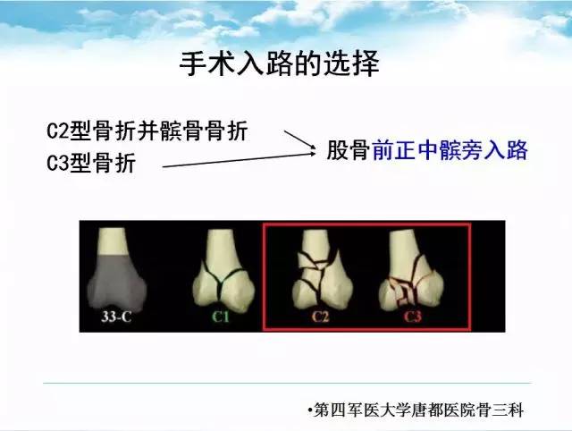 病例分享前正中髌旁入路在股骨髁部c型骨折的应用