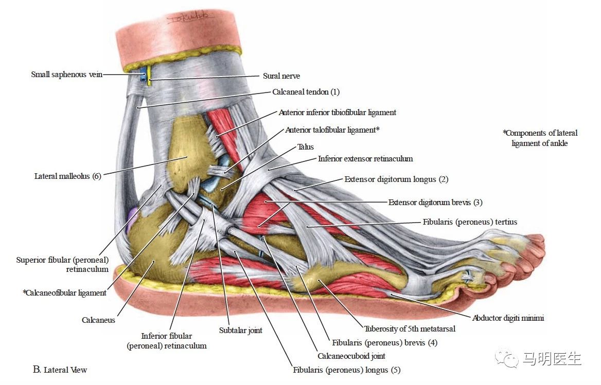 for higher fracts of the fibula, the internervous plane lies