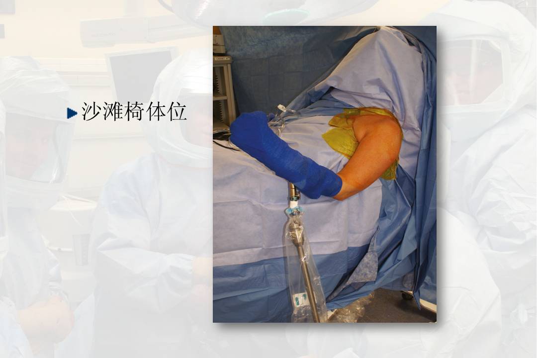 肱骨近端骨折头置换的技术及并发症
