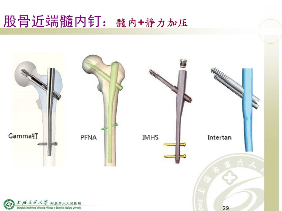 老年髋部骨折救治的策略和技术 -医学文章-唯医,allinmd
