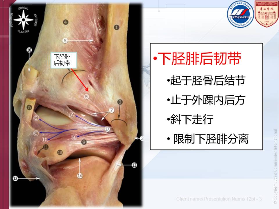 下胫腓韧带图片