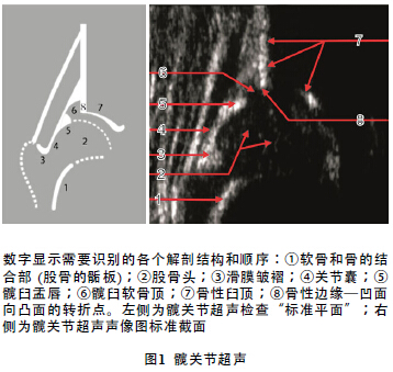 婴幼儿髋关节发育不良儿科医师如何解读超声检查