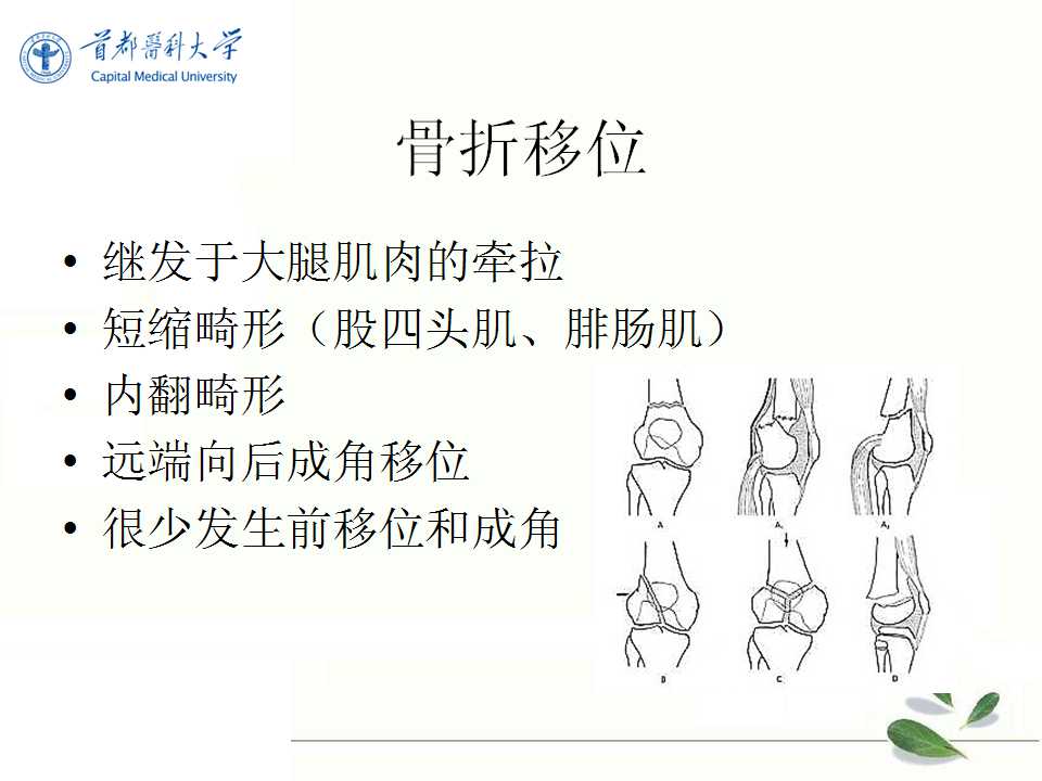 股骨远端骨折复位技巧探讨