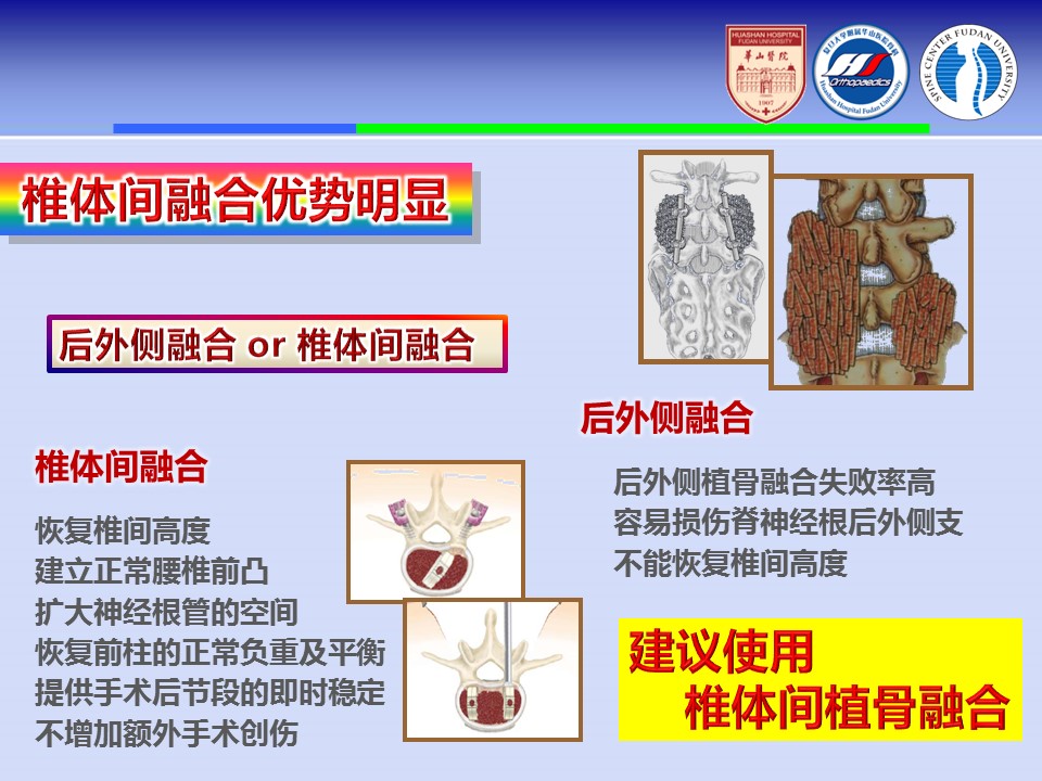腰椎改良tlif手术演示