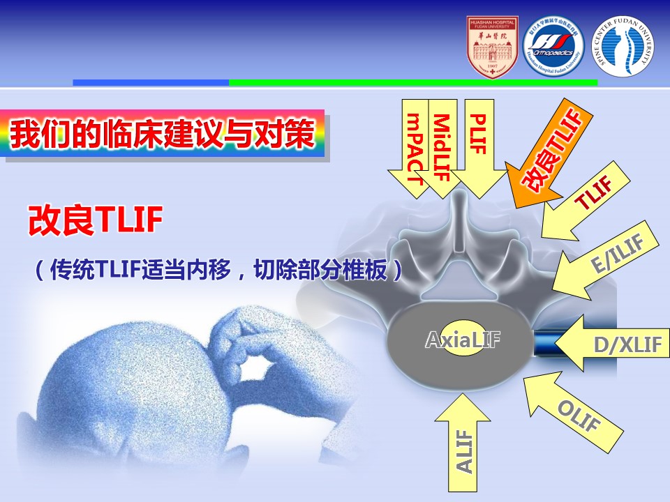 腰椎改良tlif手术演示