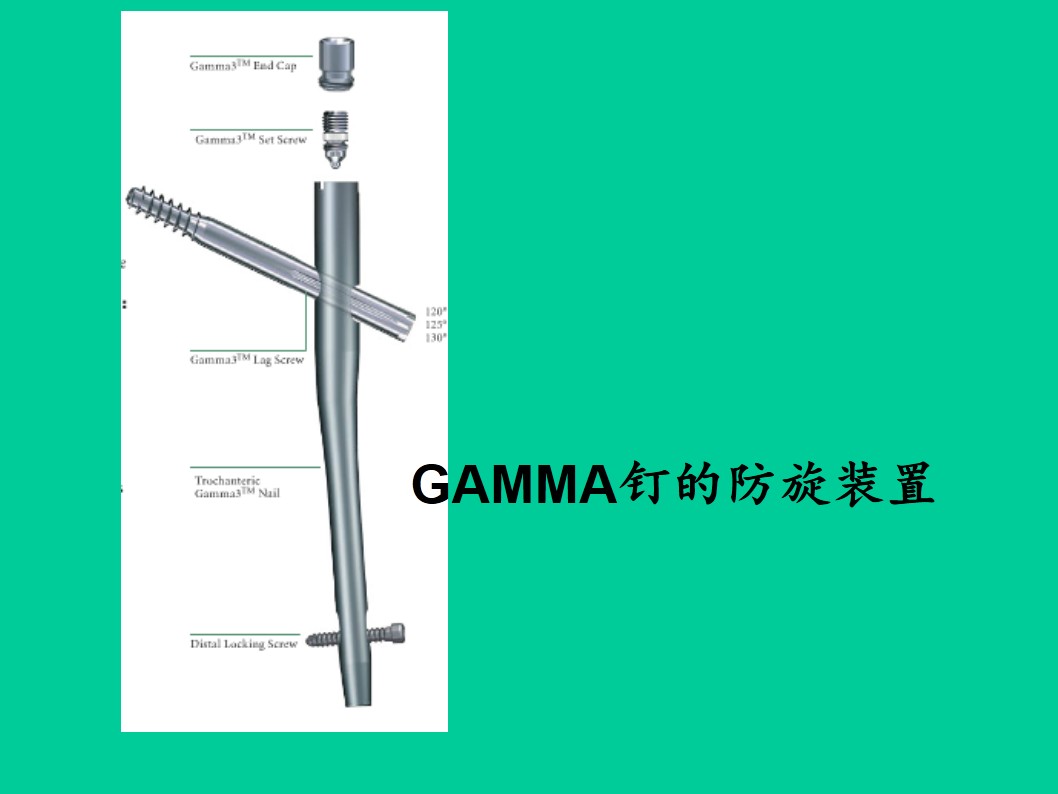 pfna与gamma钉itst治疗骨质疏松性股骨粗隆间骨折的评价