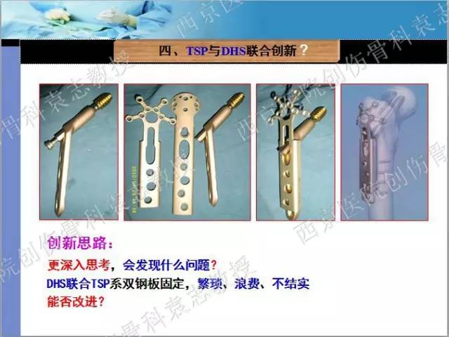 学术分享动力髋钉板dhs联合保护钢板tsp治疗股骨转子间骨折