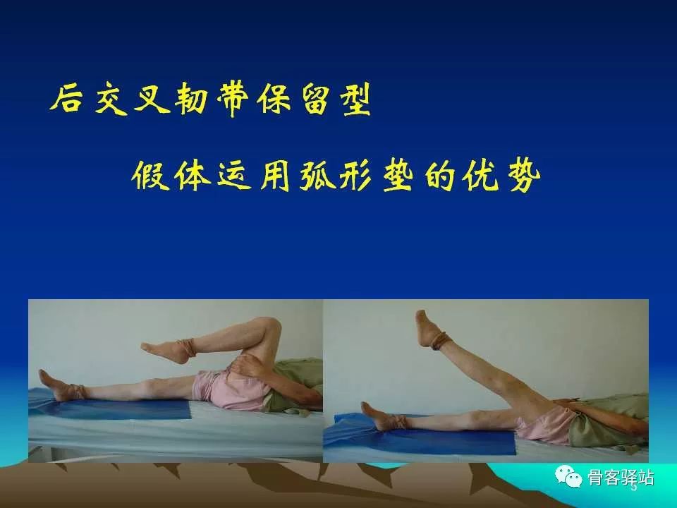 弧形垫的应用如何增加膝关节的活动度