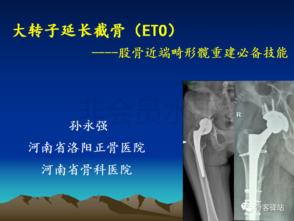大转子延长截骨股骨近端畸形髋重建必备技能