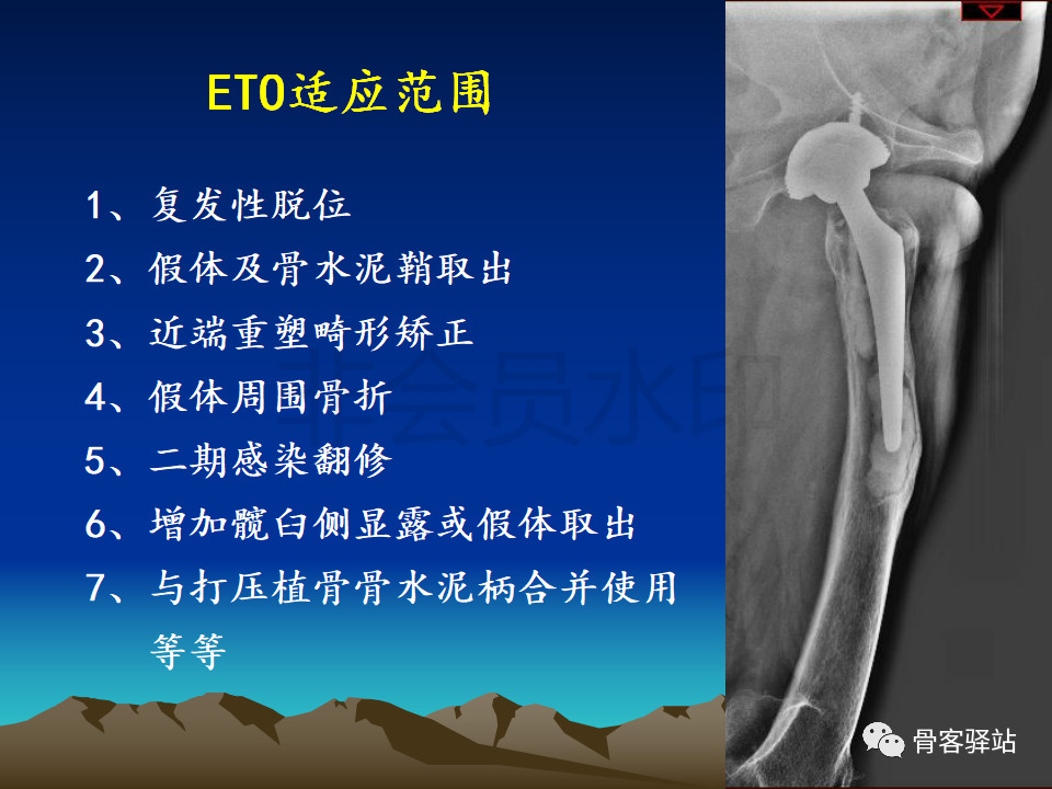 eto截骨示意图图片