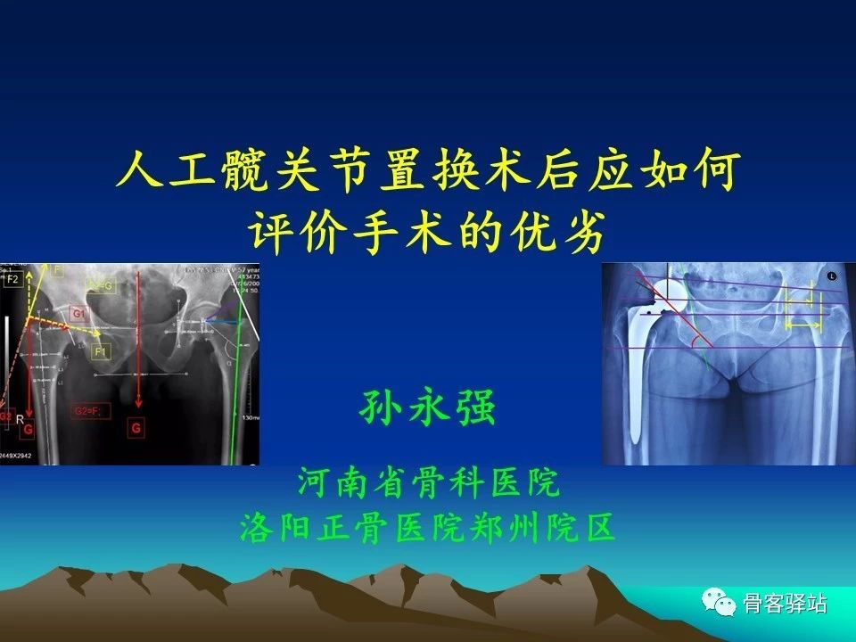 髖關節置換系列三術後x線評估