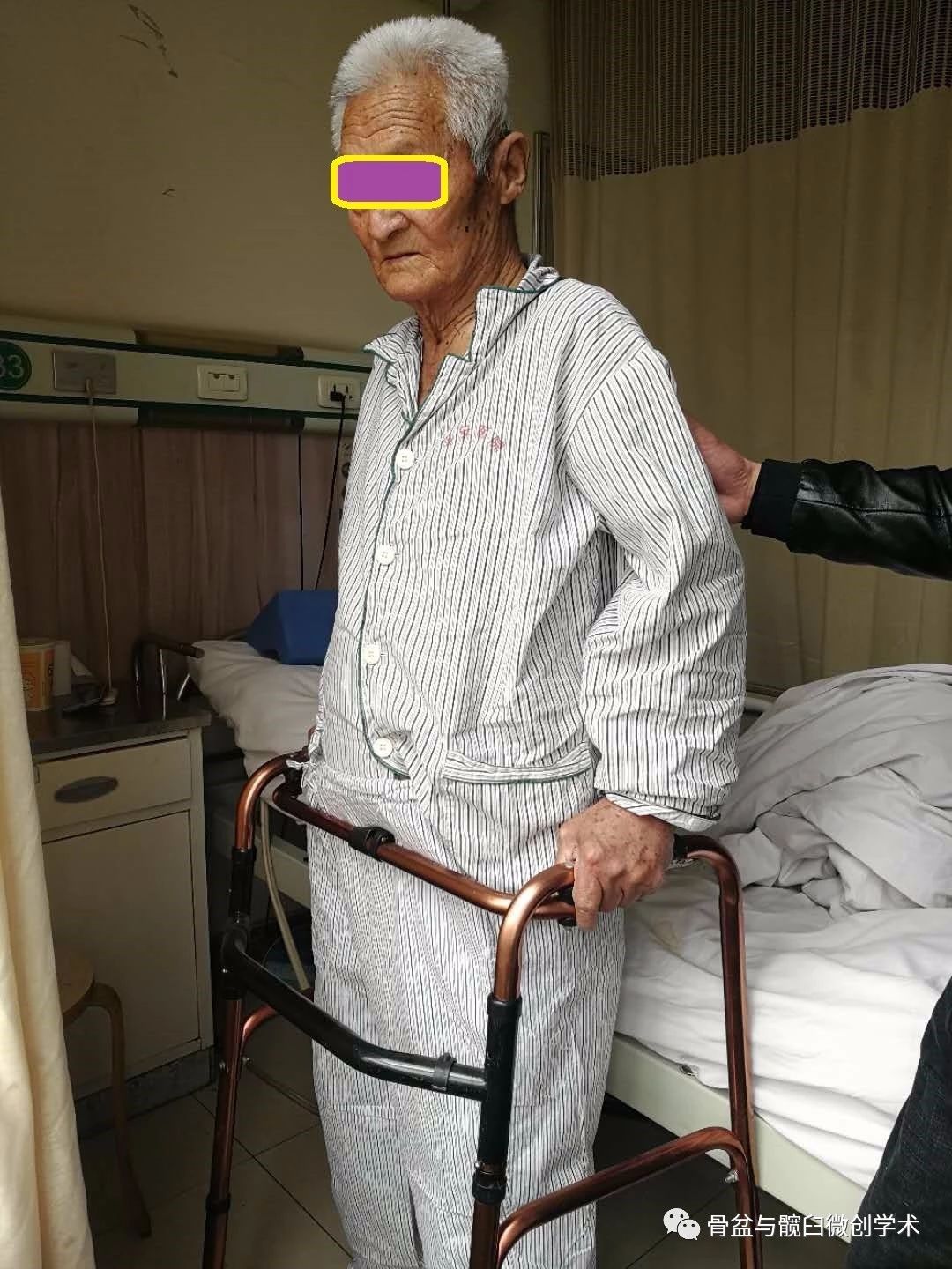 兄弟携手共进医患美好共筑一例老年骨盆骨折病人的微创手术