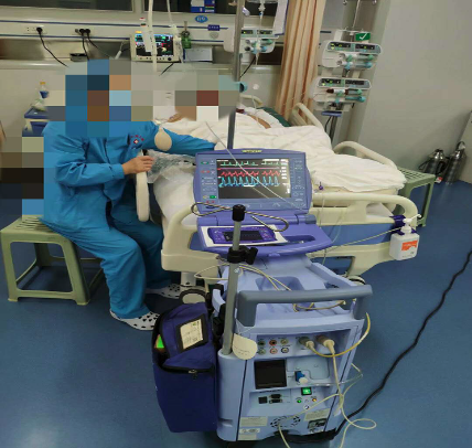 主动脉内球囊反搏术(iabp)