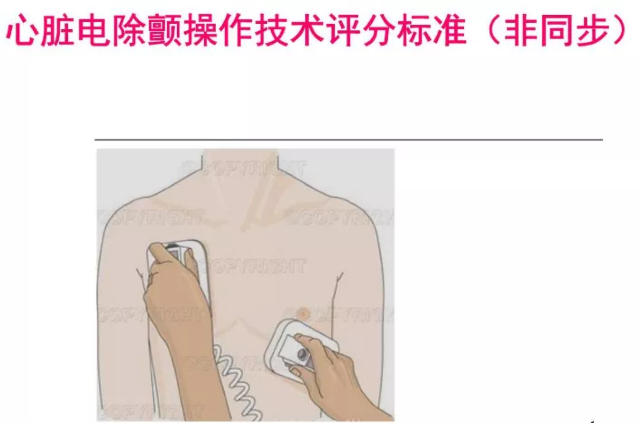 电除颤位置图片图片