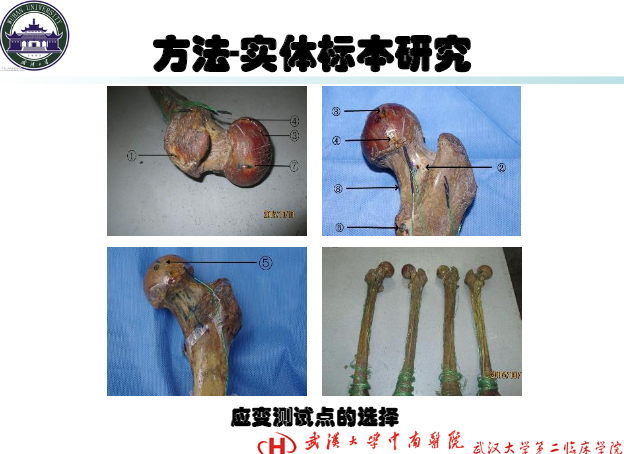 唯醫專題|創傷系列Ⅴ——股骨頸骨折